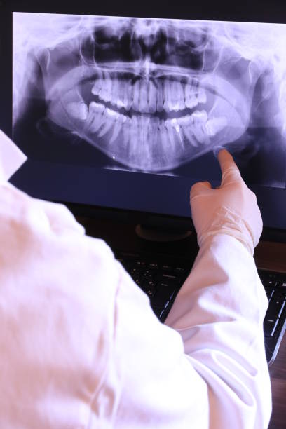 Best Emergency Dental Surgery in Rossvle, IL