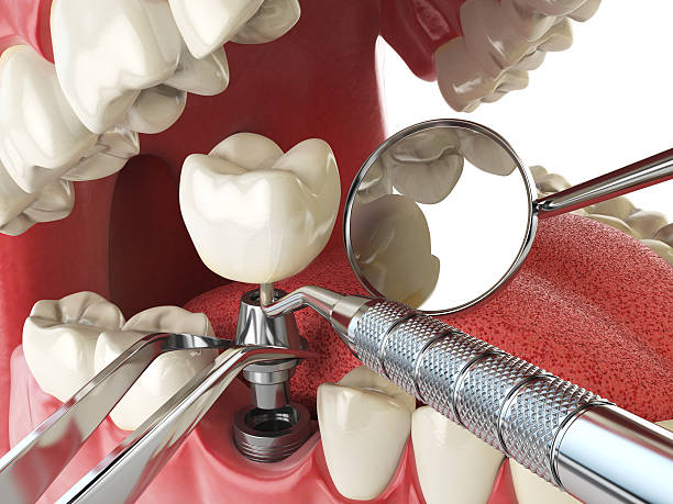 Best Urgent Dental Care in Rossvle, IL