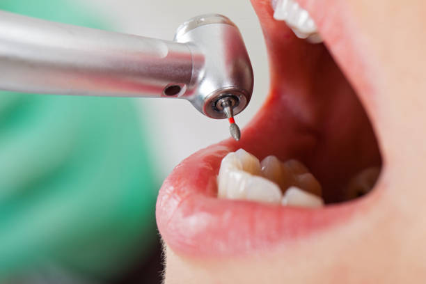 Best After-Hours Emergency Dentist in Rossvle, IL